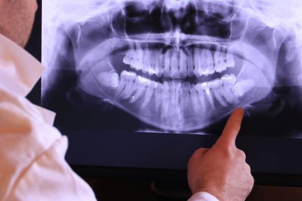 Best Emergency Treatment for Toothache in Raubsville, PA